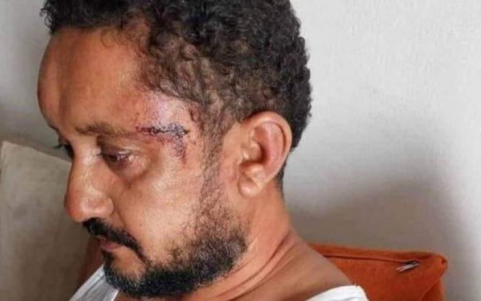 الاحتفاظ بثلاثة أمنيين على خلفية الاعتداء على الصحفي سفيان بن نجيمة