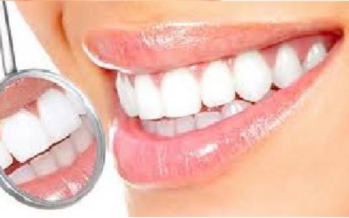 تريد أسناناً أكثر بياضاً وإشراقًا؟ إليك 7 طرق بسيطة للتخلص من البقع وتبييض أسنانك